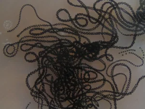 Common toad egg strands